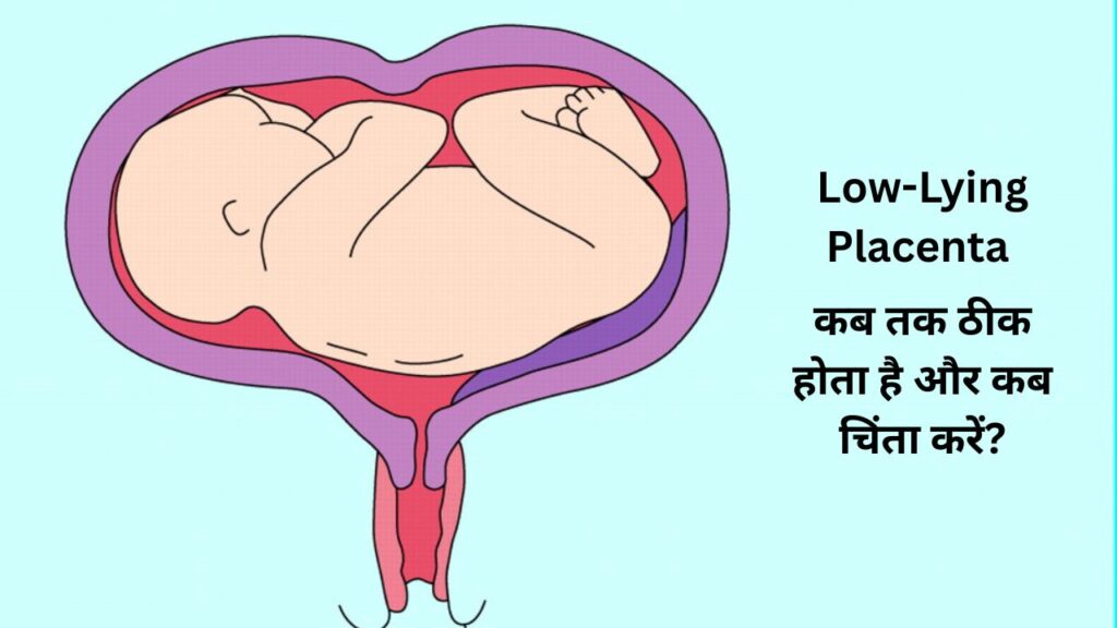 low lying placenta
