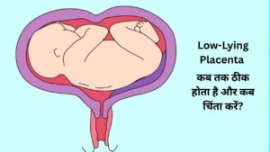 low lying placenta