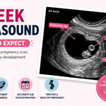 6 Week Ultrasound picture