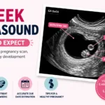 6 Week Ultrasound picture