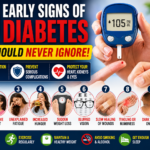 10 Early Signs of Diabetes You Should Never Ignore