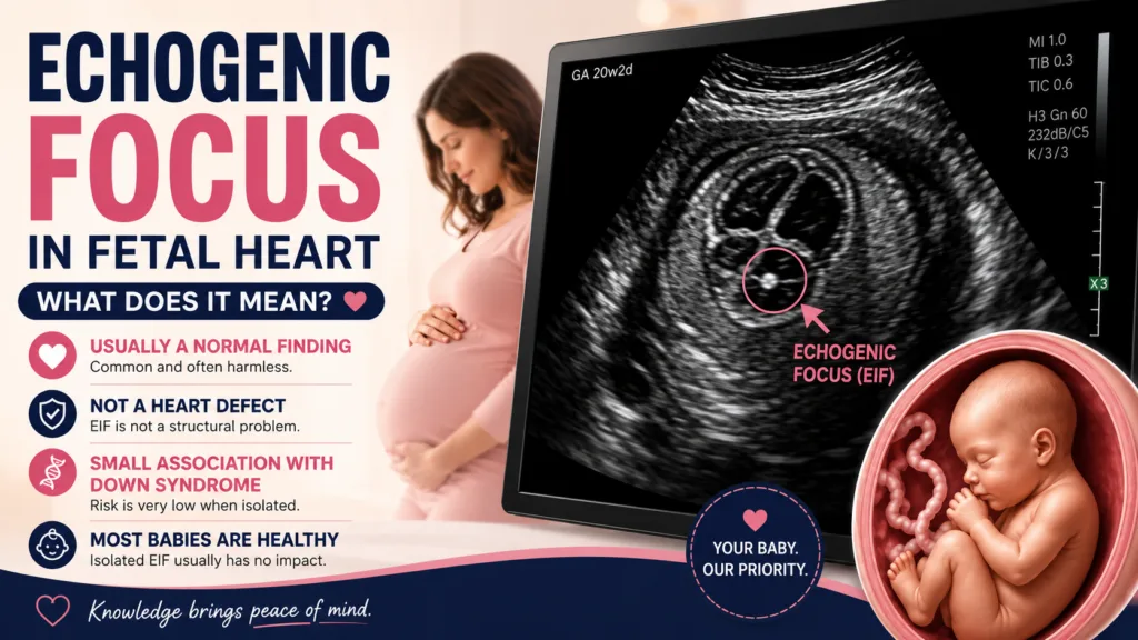 Echogenic Focus in Fetal Heart: What Does It Mean? Echogenic Focus in Fetal Heart