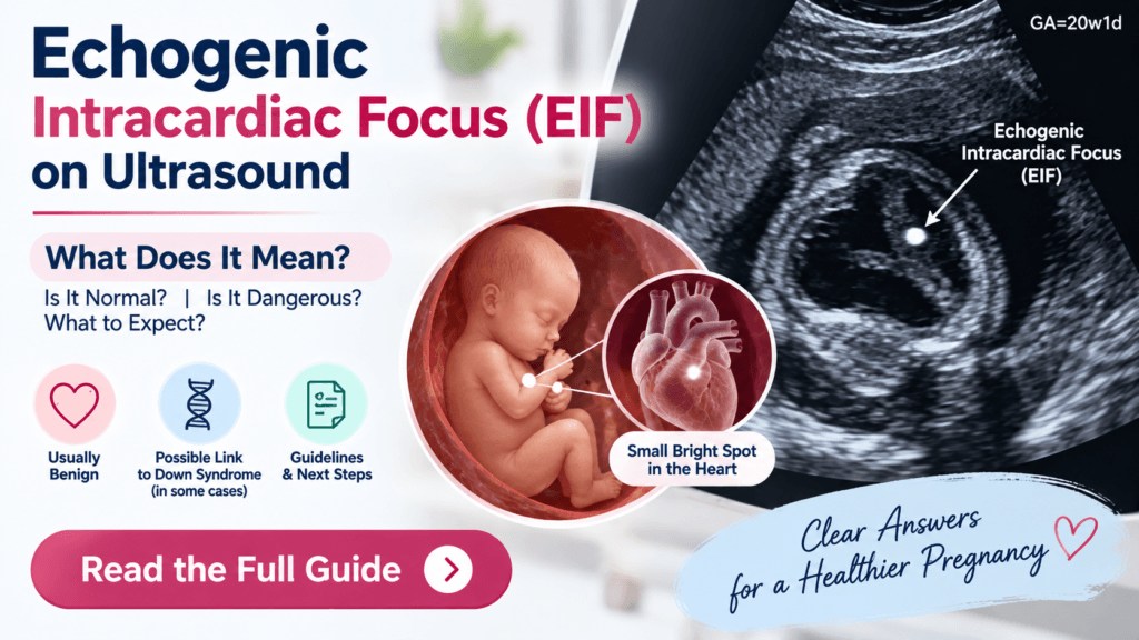 Echogenic Intracardiac Focus (EIF) on Ultrasound