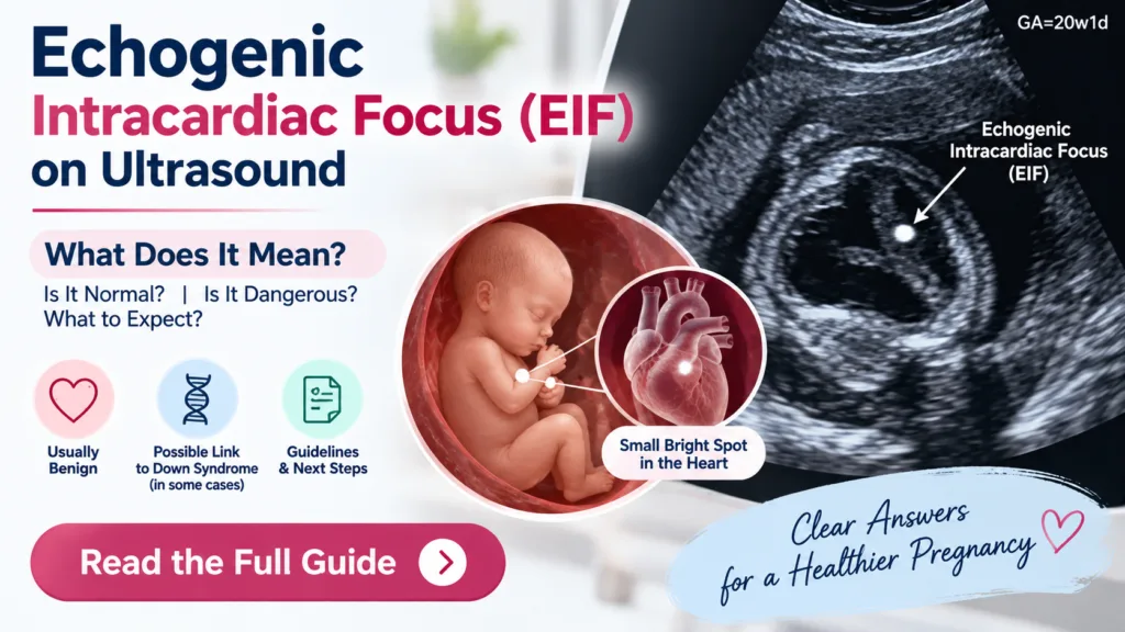 Echogenic Intracardiac Focus (EIF) on Ultrasound: What Does It Mean? Echogenic Intracardiac Focus (EIF) on Ultrasound