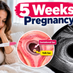 5 weeks pregnancy ultrasound guide